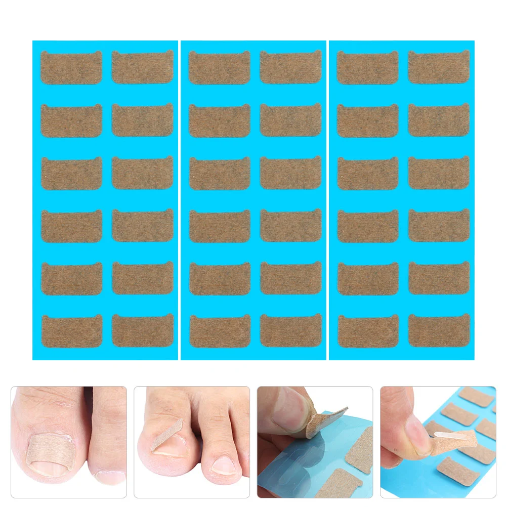 

36 Pcs Stickers Nails Ingrown Corrector Toenail Decals Patch Recover Tape