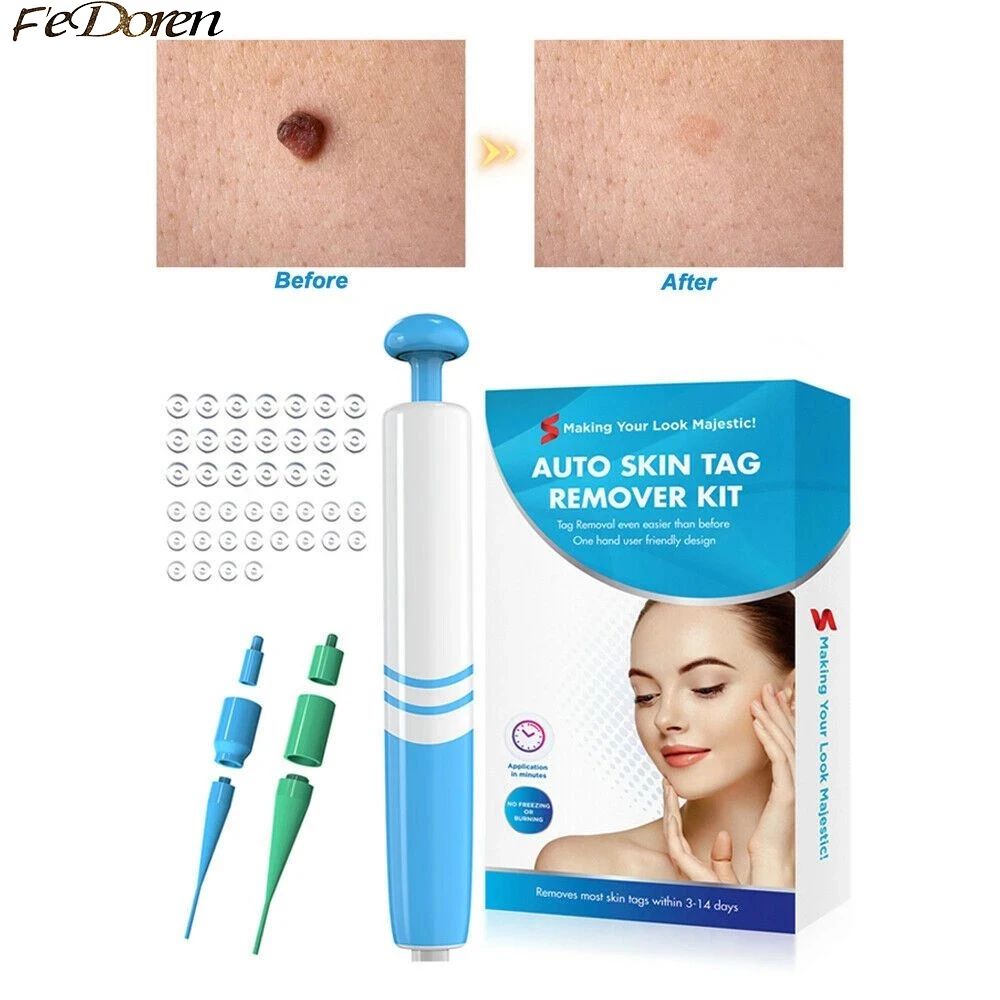 

Средство для удаления этикеток на коже, набор для удаления этикеток на коже, средство для удаления бородавок на коже, устройство для удалени...