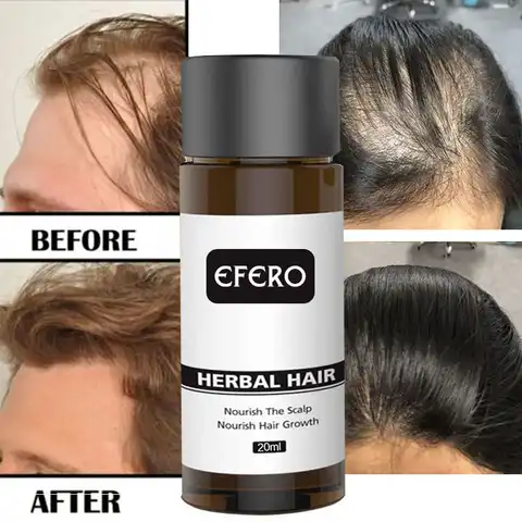 Fast Hair Growth Oil Product Prevent Hair Loss Hair Regrowth Essential Oil Dense Hair Restoration Growing Serum Hair Care 20ml