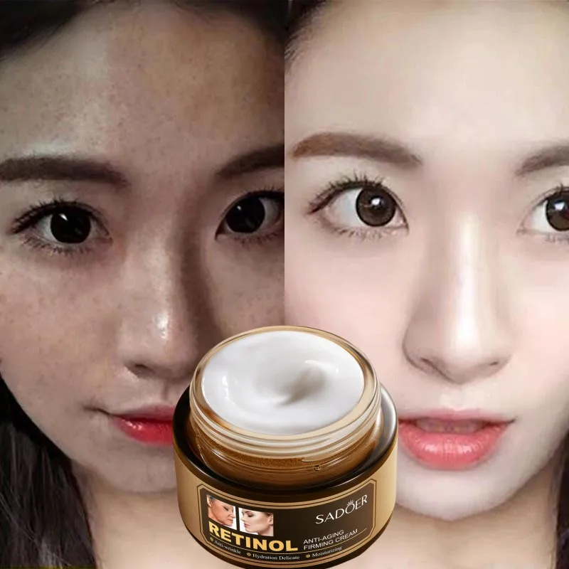 

Bright Skin Cream Powerful Whitening Freckle Cream Remove Melasma Acne Spots Pigment Melanin Dark Spots Face Care Cream