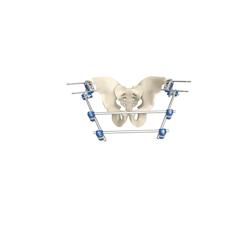 

Лидер продаж, ортопедический тазовый фиксатор