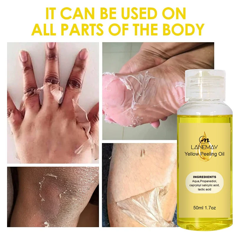 

Yellow Peeling Oil Dark Skin Bleaching Remove Arm Knee Legs Melanin Body Brighten Scrub Exfoliating Dead Skin Care Whiten Serum