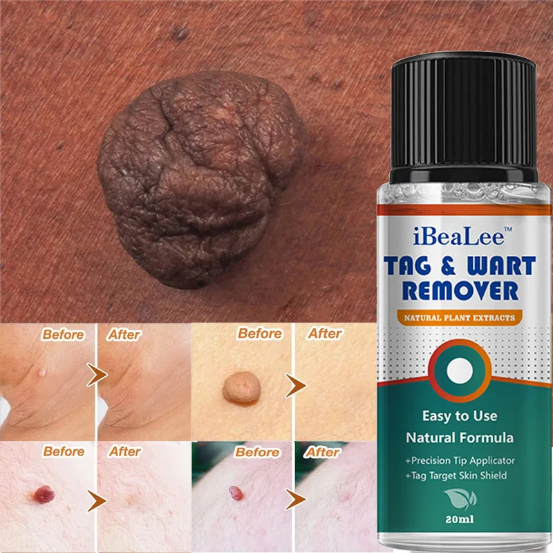 

Сыворотка для безболезненной кожи, 5/20 мл