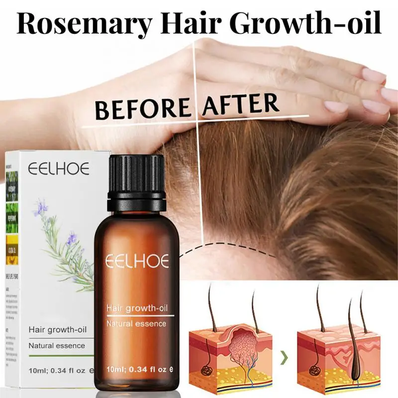 

Eelhoe Rosemary Hair Growth Essential Oil Anti Hair Loss Products Fast Regrowth Serum Scalp Treatments Repair Damaged Hair Care