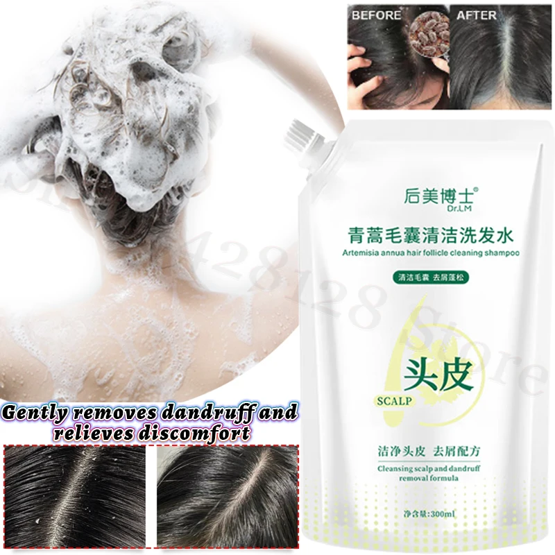 

Artemisia Annua Repair Hair Follicle Shampoo Oil Control Deep Cleansing Mild Dandruff Control Relieve Scalp Itching Shampoo