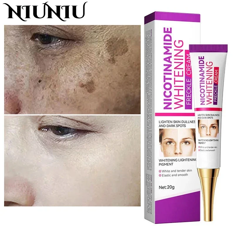 Кремы для лица Fade Dark Skin отбеливающий лосьон удаления меланина уход за лицом