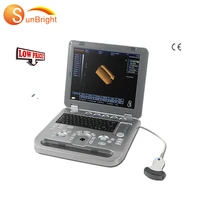ultrasound ultrasound instrument scanning device 3d portable sun 800d ultrasonic scanner