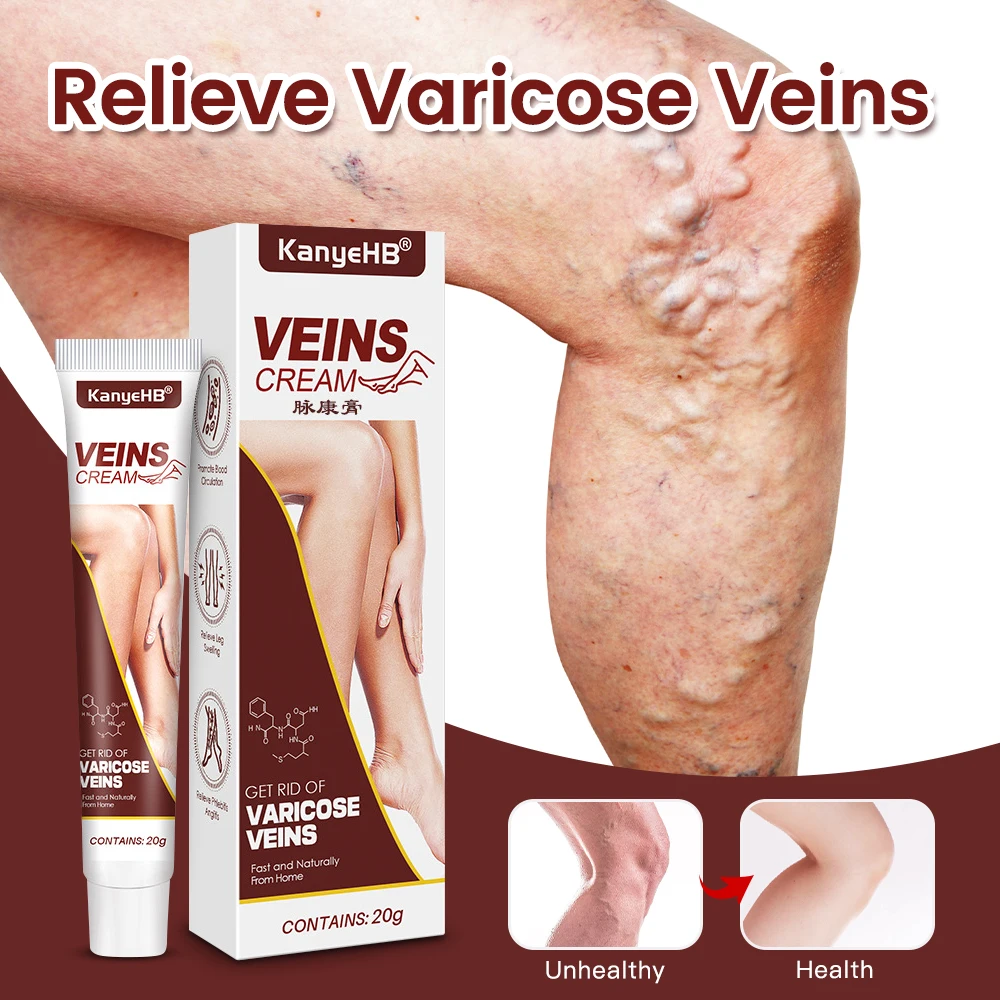 

Эффективный крем для облегчения варикозного расширения вен, устранение сосудистой сетки, лечение флебита, Успокаивающая мазь для облегчения боли