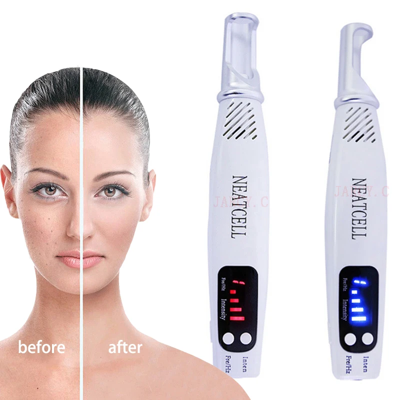 Portable Blue Red Laser Picosecond Pen for Face Skin Care Beauty Light Therapy Tattoo Wart Mole Freckle Scar Removal Plasma Pen