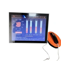touch screen 8 0mp professional uv skin analyser machine with ce certificate approval