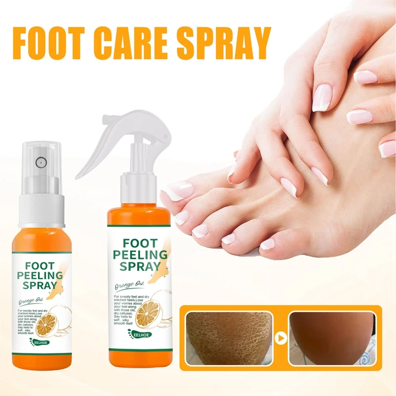 

30/100ml New Foot Peeling Spray Natural Orange Essence Pedicure Hands Dead Skin Exfoliator Whiten Foot Exfoliating Care Tool