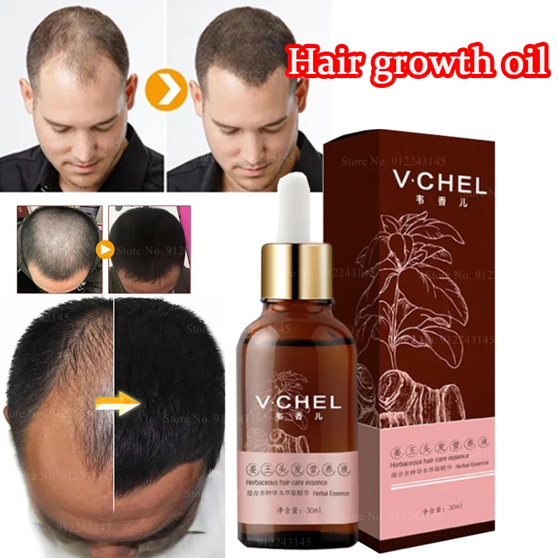 

Hair Nutrient Solution Hair Loss Treatment Maintenance Damaged Hair Roots Hair Care Essential Oil Growth Nourishing Fluid