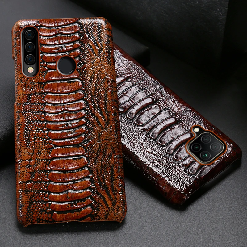 

Leather Phone Case For Huawei Honor 30 30S X10 20 20i 10 10i 9 8 Lite 9X 8X Max 7X 7A V30 Pro V20 V10 Ostrich Foot Texture Cover