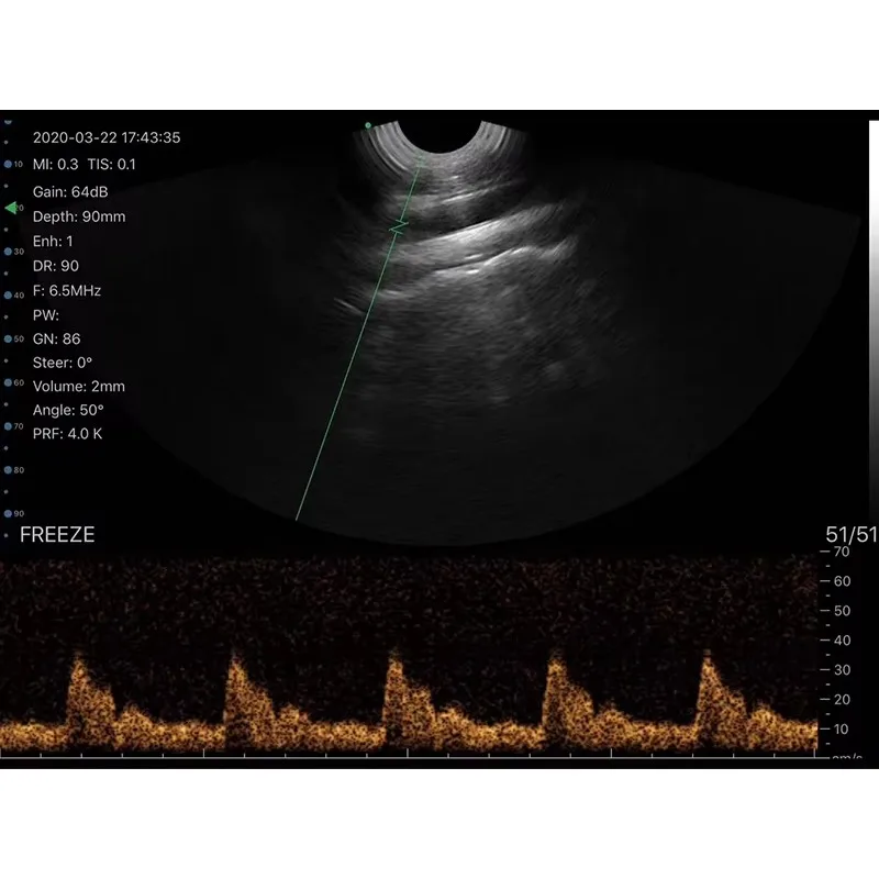 Ручной ультразвуковой зонд для трансгинальной матрицы 4T, беспроводное устройство для ультразвукового мониторинга ладони, ветеринарный (art.: 3920d05e54280) - 3920d05e54280