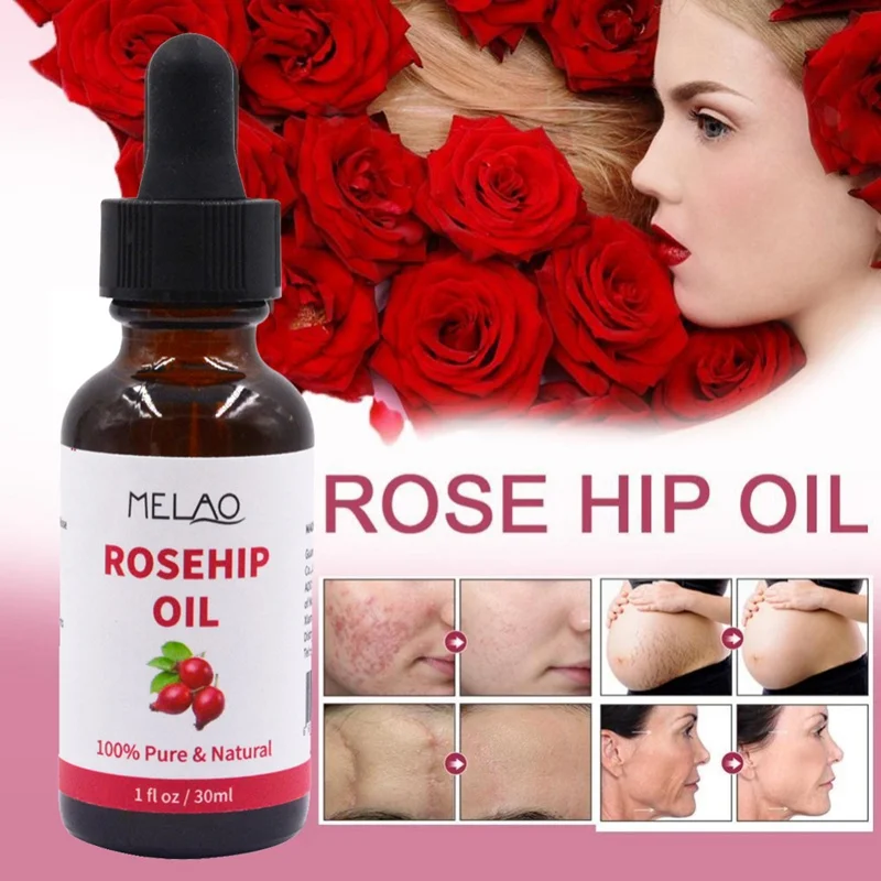 

30ml Rosehip Ginger Body Massage Essential Oil Nail Nourish Improve Muscle Soreness Pain Relax Beauty Health Care Candle Making