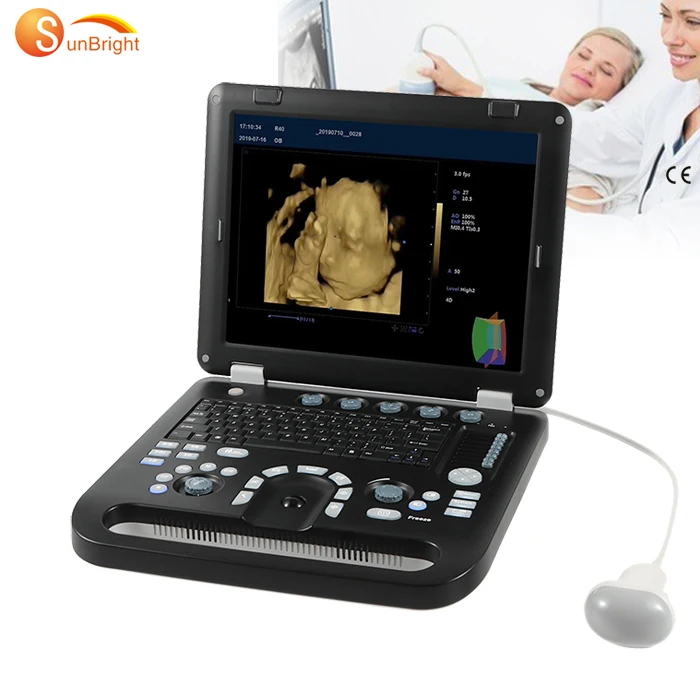 ultrasonido z60 color doppler ultrasound usg 4D Laptop Cardiac Phased Array Color Doppler