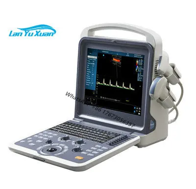 

DUS80 high quality Portable color color doppler ultrasound