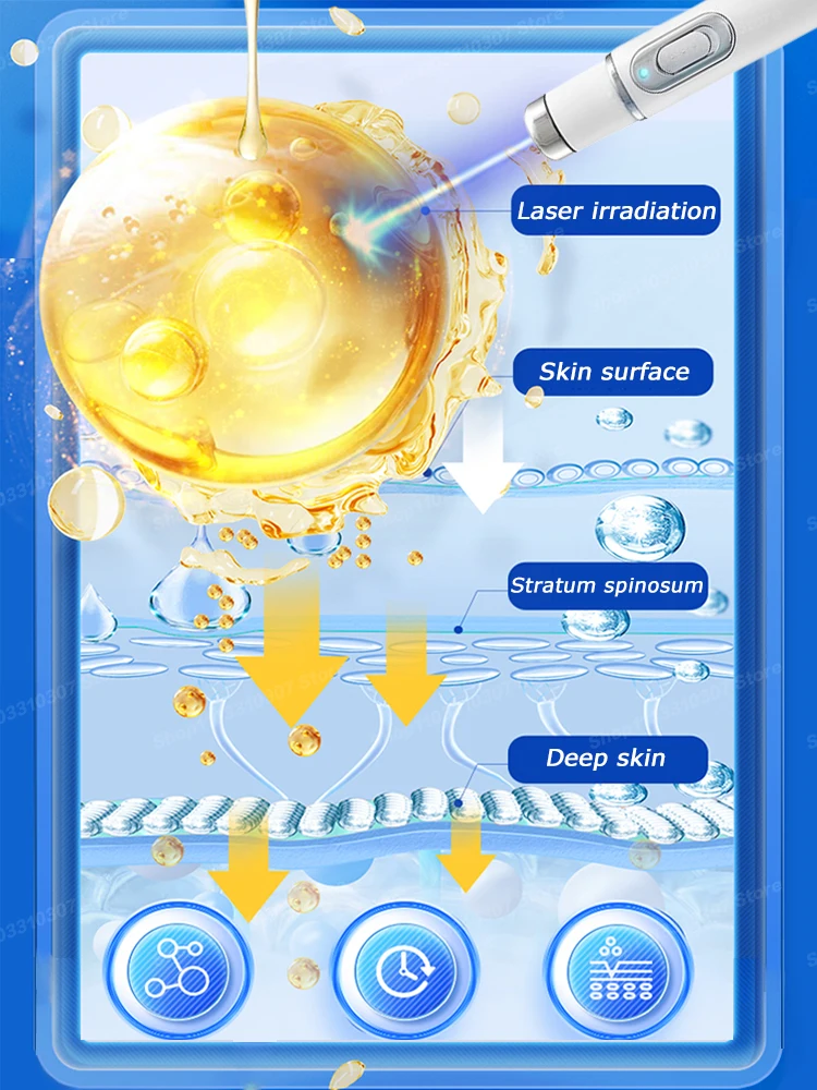 Крем Varicosse Blu-Ray pen