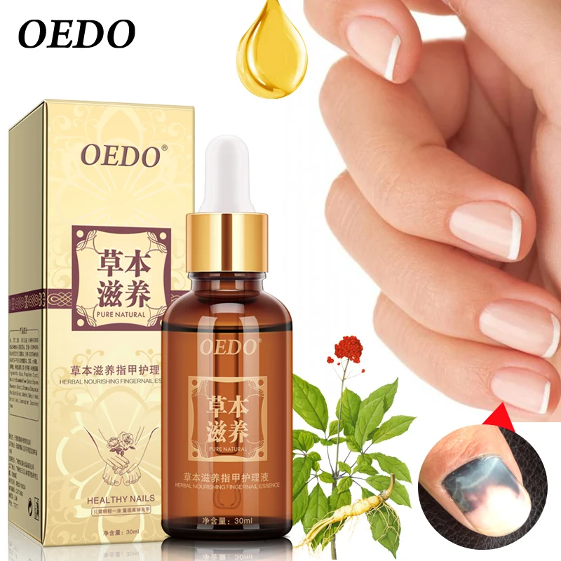 

30ml Herbal Nourishing Nail Care Essential Oils Hand Foot Toenail Fungus Removal Infection Foot Care Polishing Nail Polish