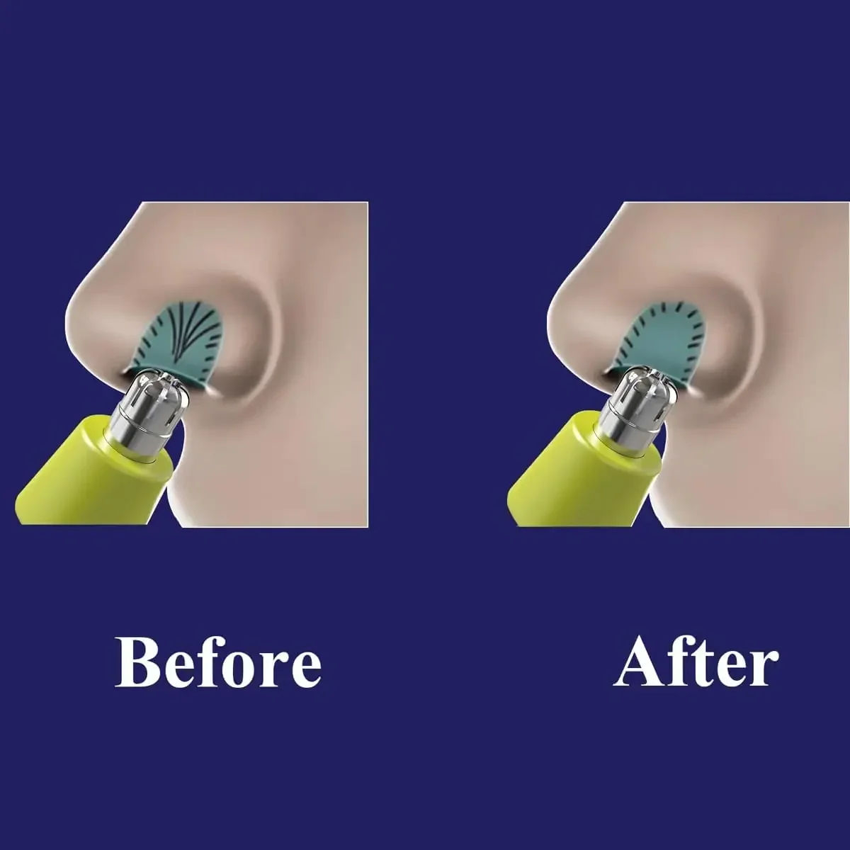 Головки сменные для триммера Philips QP2520 QP2515 QP2630 QP6510 QP6520 QP6530