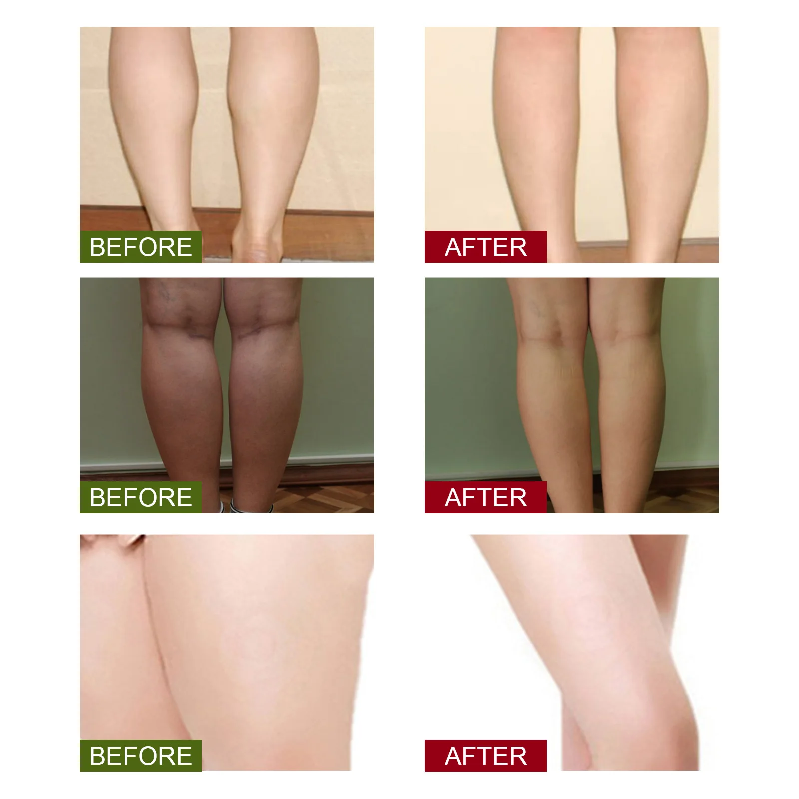 16 шт. пластырь из полыни для ног |