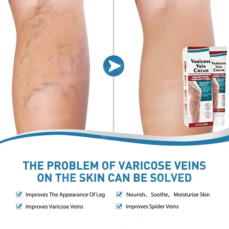 Уход за ногами уход красотой и здоровьем эффективно успокаивает варикозное