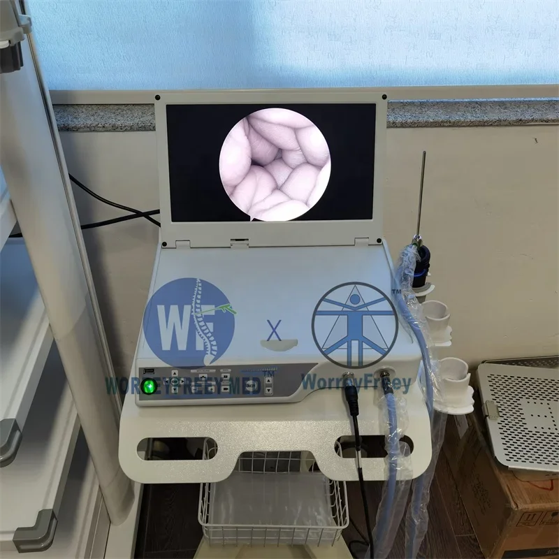 HD переносная эндоскоп-камера медицинский эндоскоп позвоночника Discectomy Interlaminar