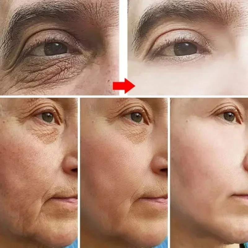 Крем для лица с ретинолом удаления морщин укрепляющий лифтинг против старения