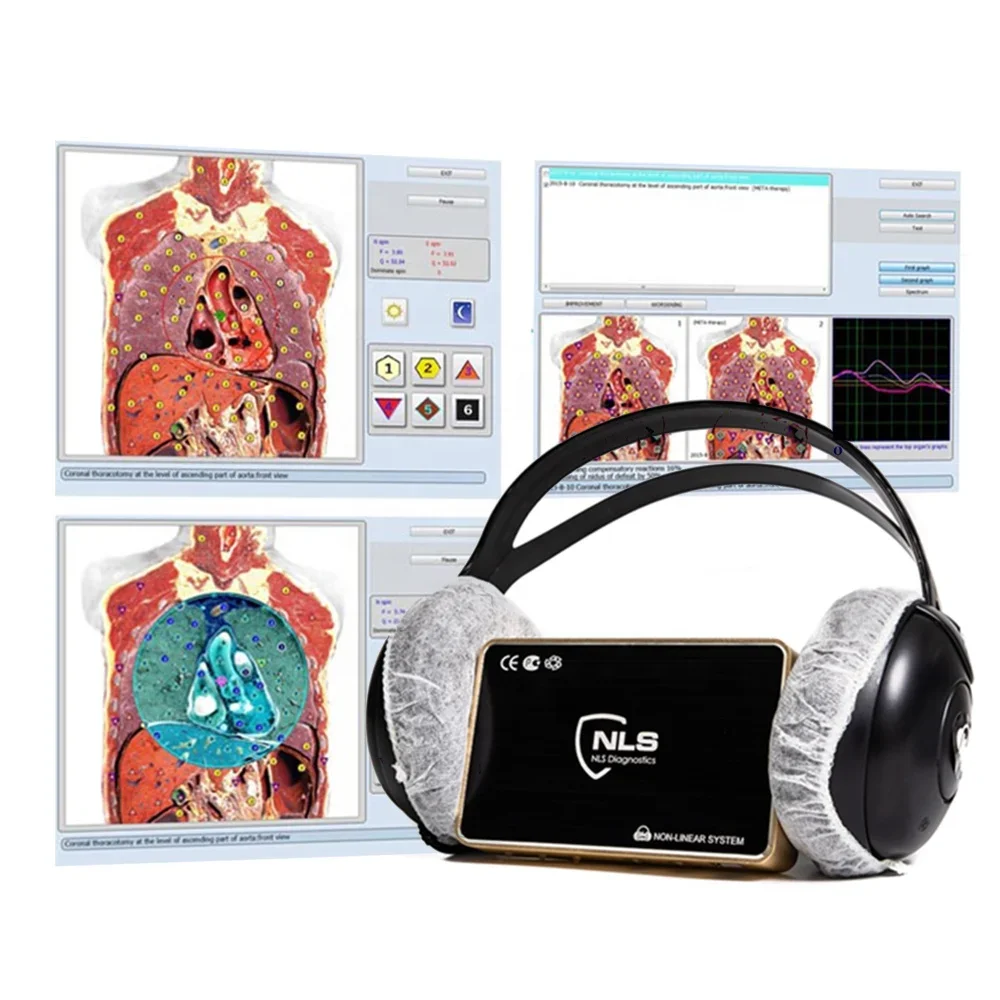 Квантовый резонанс 9d био 8d iris NLS анализатор здоровья (VT-9D)