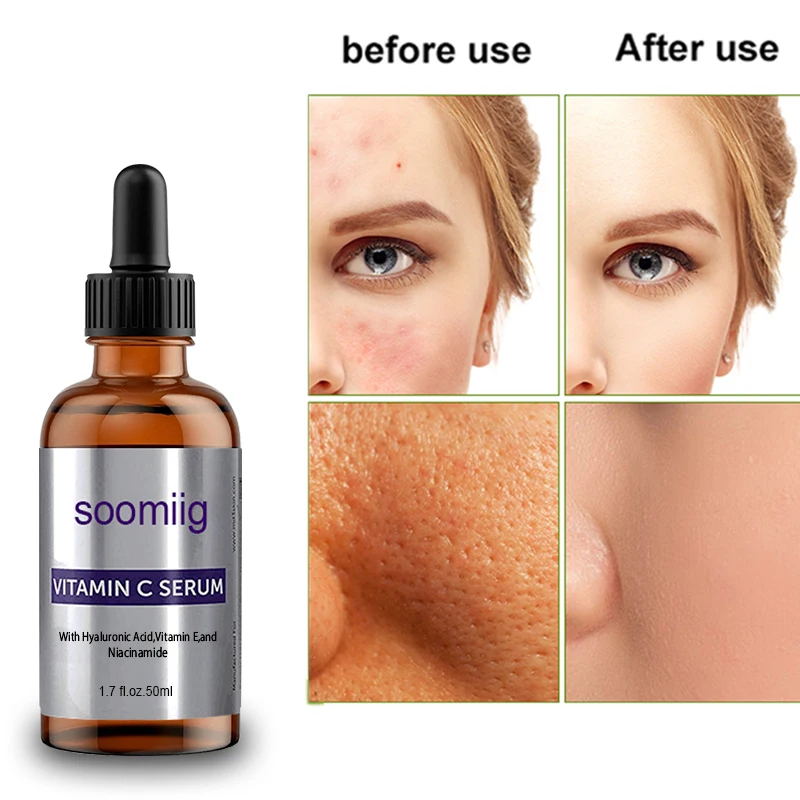 

SOOMIIG GLAMOUR Hyaluronic Acid Face Serum Anti-Aging Shrink Pore Whitening Moisturizing Essence Face Cream Dry Skin Care 50ml
