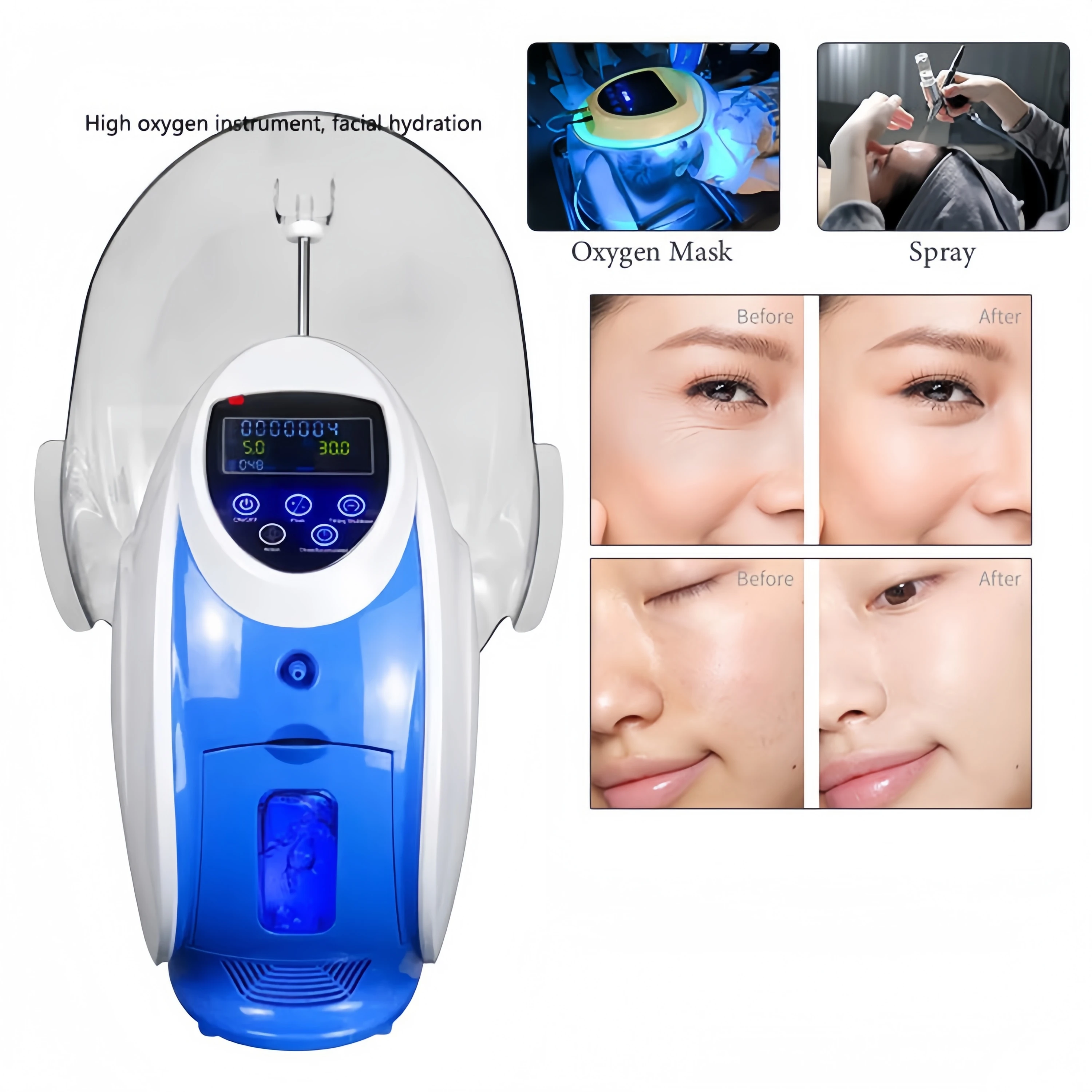 Кислород O2derm Кислородная маска для лица Купольная терапия Кислородная инфузионная машина для лица Портативная Корея O2 для дерма Чистая глубокая очистка лица (art.: 3920d46dde781) - 3920d46dde781