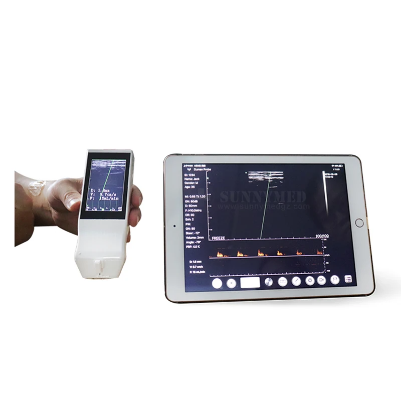 

Sy-AC50 Hospital WiFi/Wireless Color Doppler Nephrology/ Hemodialysis/ Hematology Ultrasound Puncture Probe
