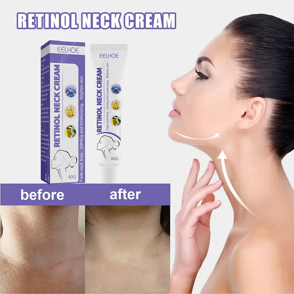 

Lighten Neck Lines Massage Cream Moisturizes Tightens Neck Skin Reshape Swan Neck Retinol Beauty Skin Care Cream Top Selling