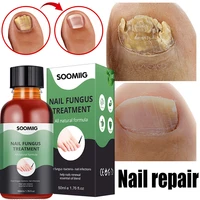 nail fungal treatment feet care essence anti infection paronychia onychomycosis nail foot toe nail fungus removal gel products