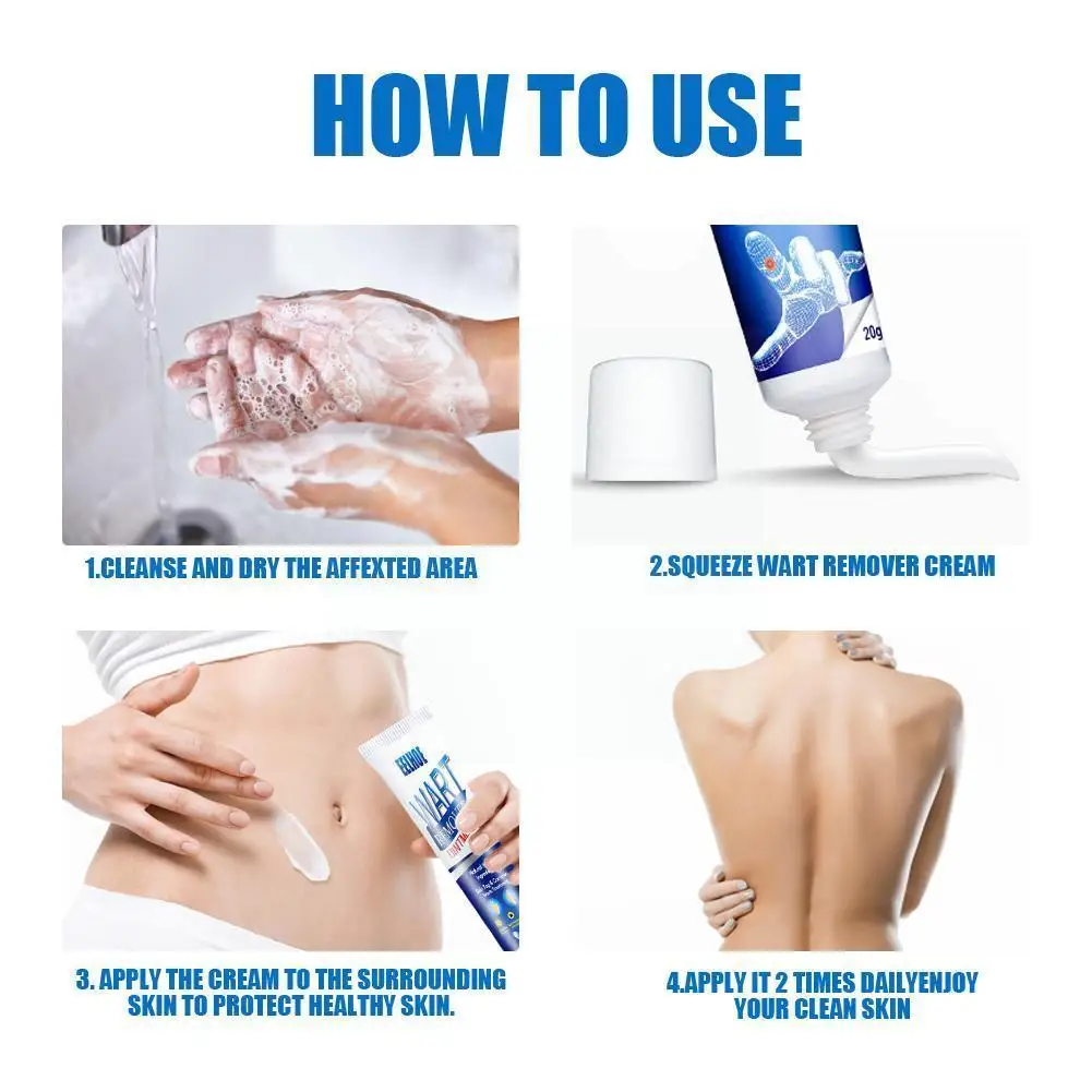 

Instant Blemish Removal Gel Wart Removal Body Warts Cream Care Wart Tag Cream Remover Cream Treatment Skin Foot Z2j8