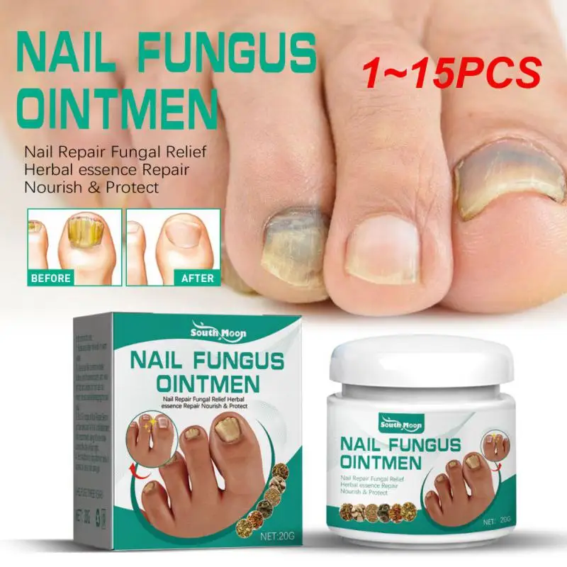 

1~15PCS Onychomycosis Nail Fungus Extremely Strong Removal Foot Care Cream Anti- Paronychia Nail And Toe