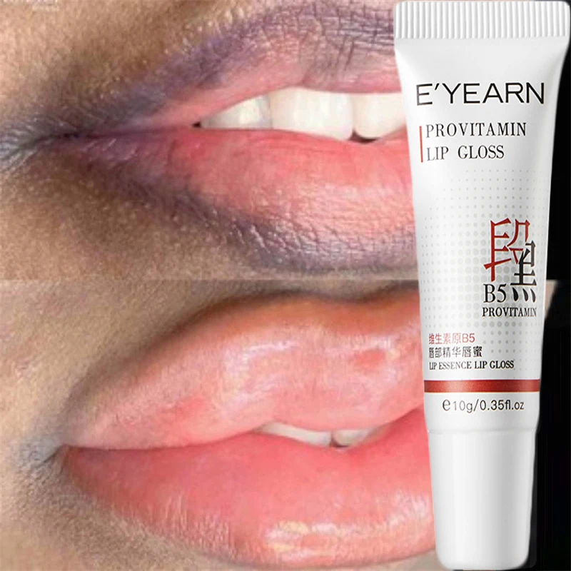 

Black Lip Lightening Lips Serum Remove Dull Black Lip Reduce Pigmentation Fade Lips Lines Product Moisturize Nourish Lip Care