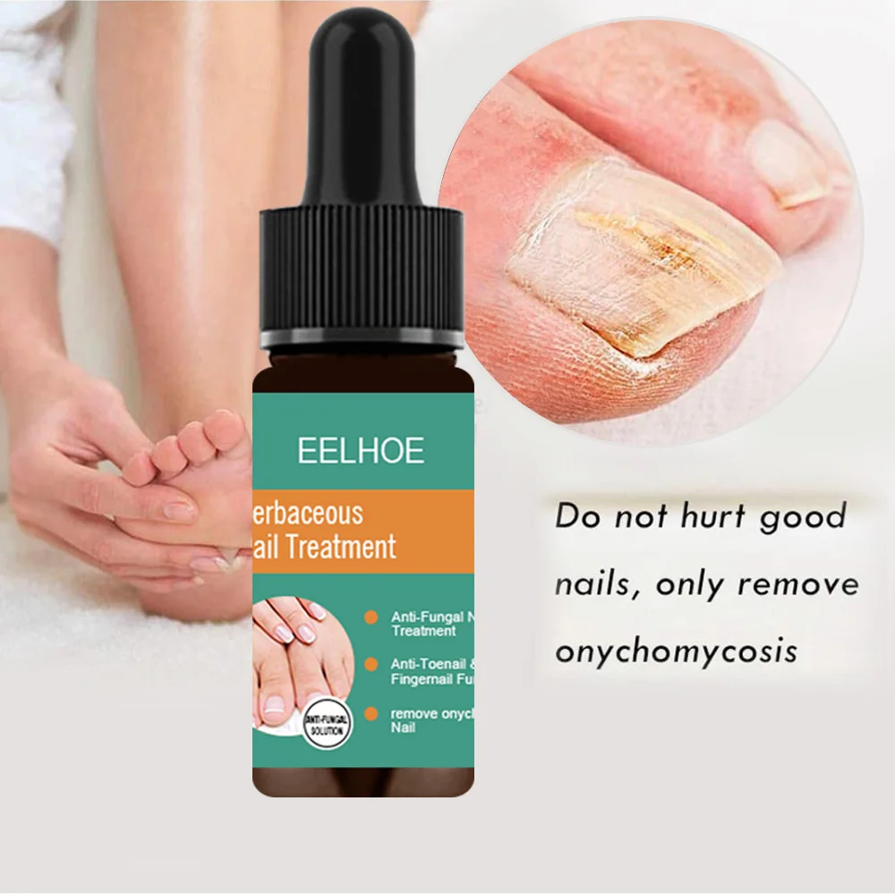 средство от грибка ногтей. какое средство от грибка ногтей на ногах. средство от грибка ногтей на ногах. средство от грибка ногтей эффективное. самое эффективное средство от грибка на ногтях.