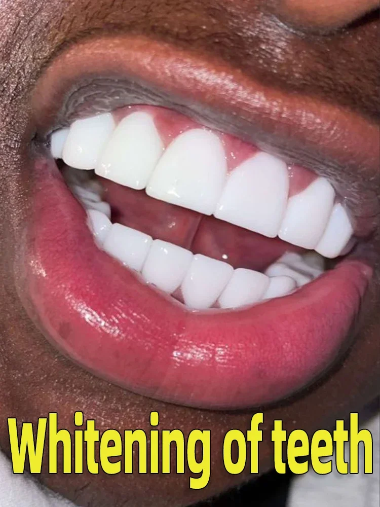 Ретолва а также унзен стоč gli ~