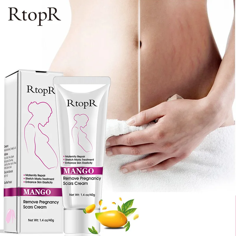 

3Pcs/lot Natural Mango Stretch Marks and Scar Cream Stretch Marks Permanent Removal Maternity Repair Lotion Anti Winkle Firming
