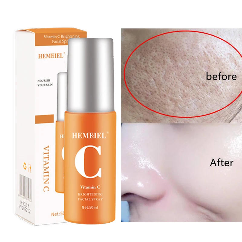 

Vitamin C Whitening Spray Brighten Moisturizing Shrink Pores Oil Control Improve Dry Skin Nourishing Sooth Face Care Products