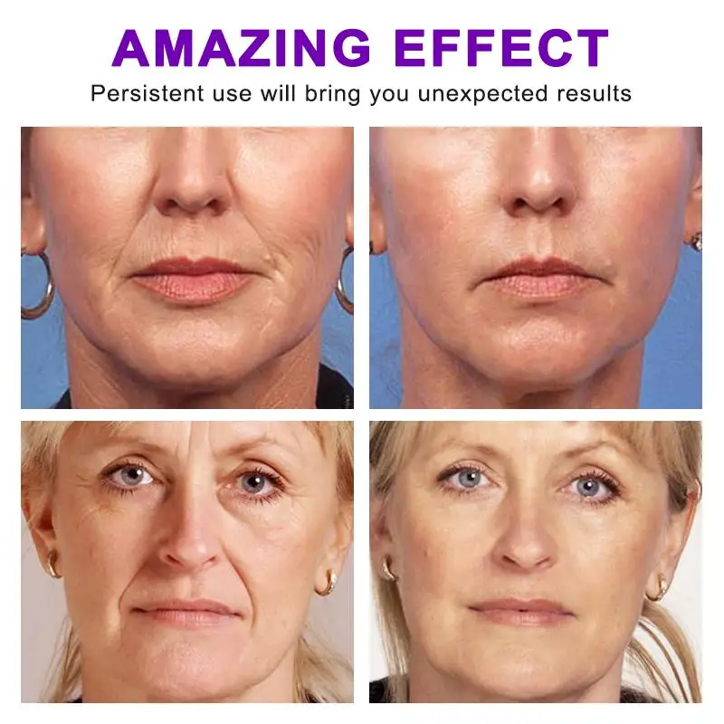 Рисунок 4 - Восстанавливающий Укрепляющий отбеливающий