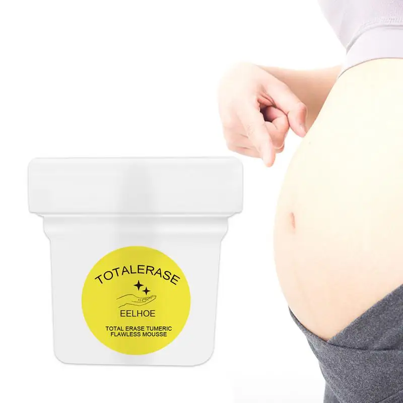 

Stretch Mark Cream For Pregnancy 100g Scar Removal Cream Stretch Mark Remover And Scar Remove Stretch Marks For Pregnancy