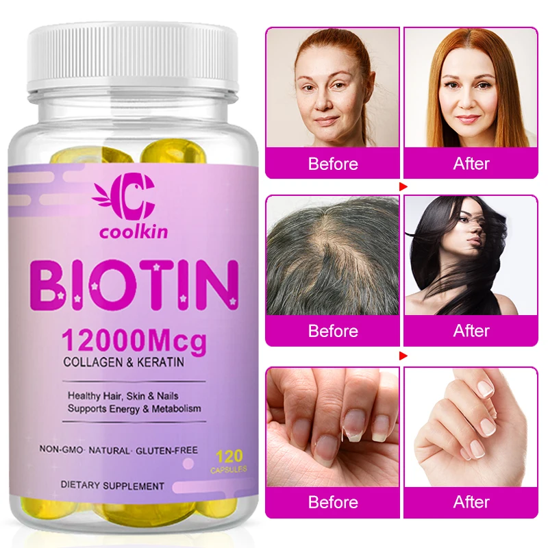 

Collagen Supplement, 12000 Mcg, for Healthy Hair, Skin & Nails, Boost Metabolism, Whitening & Anti-Aging, Vegetarian Capsules