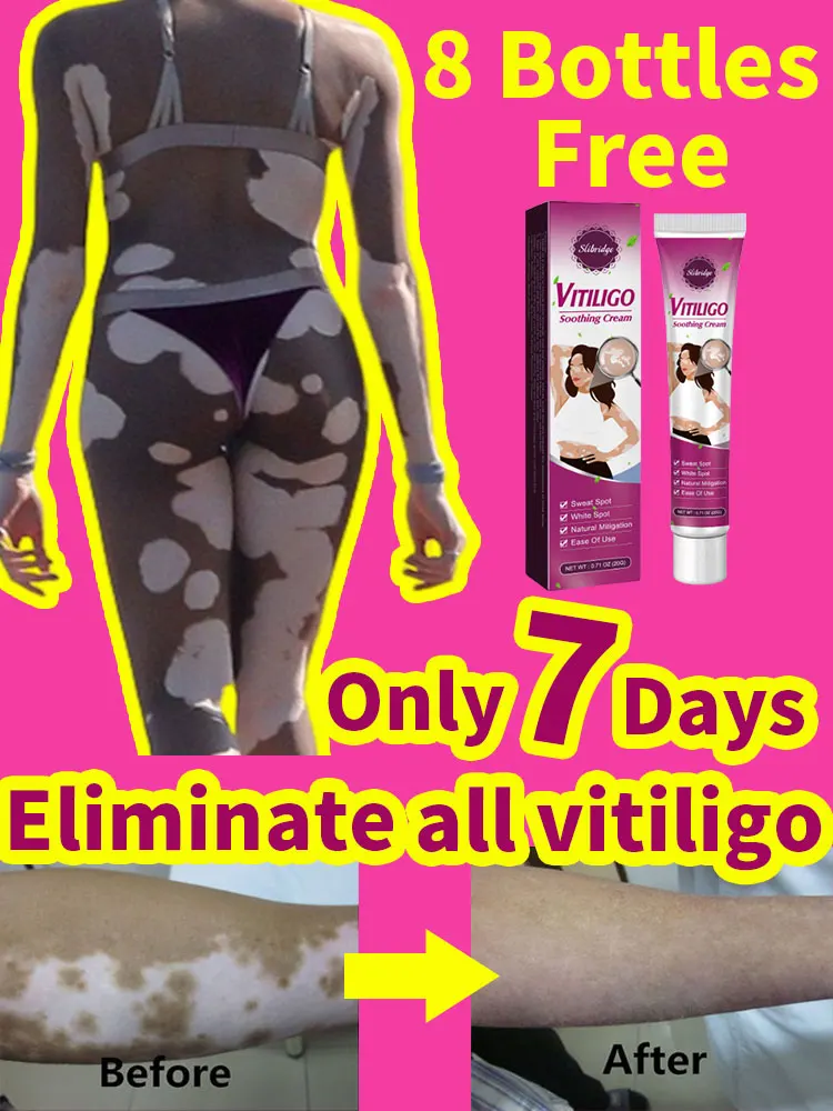 

Восстанавливающий Крем для кожи Vitiligo