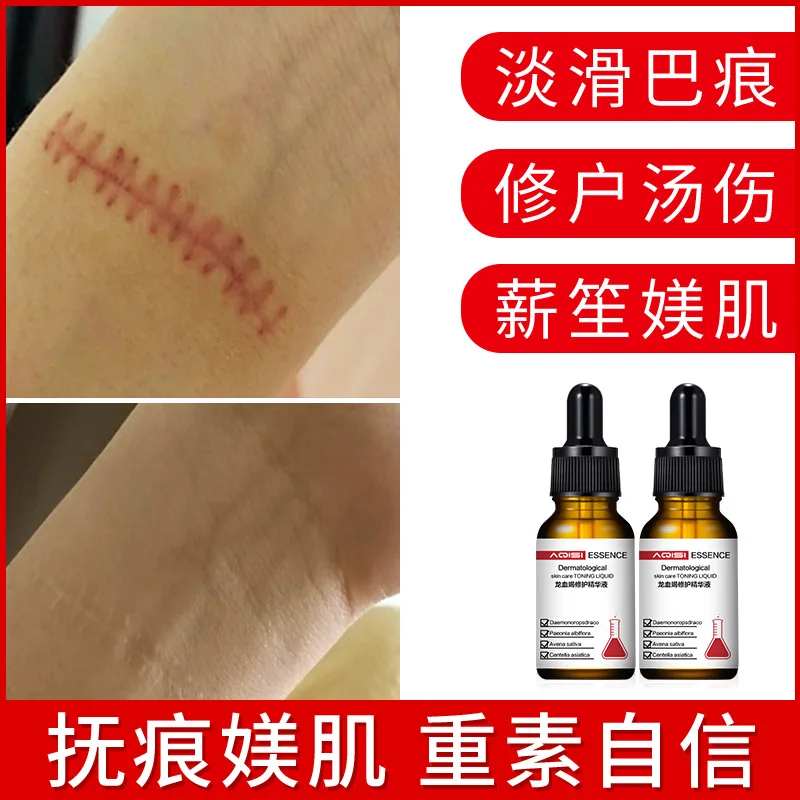 

2pcs Dragon Blood Essence Original Solution Repair Pit Acne and Acne Scar Set Box Care Bump Scar Cream Essence Serum Facial