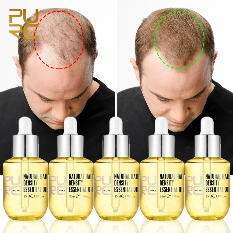 5 PCS Hair Growth Oil Hair Care & Styling Products Ginger Serum Fast Regrowth Anti Loss Hair Essence Thickener Scalp Treatment