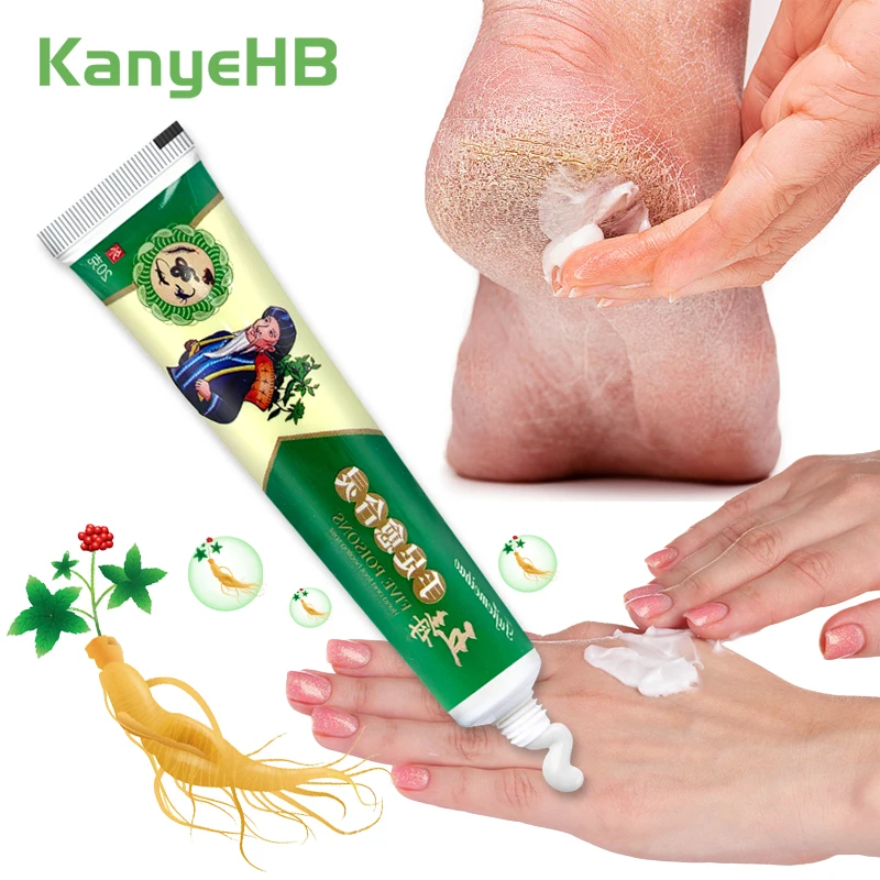 

1pcs Skin Anti Chap Moisturizer Repair Frostbite Ginseng Ointment Chilblains Skin Dry Itchy Red Swollen Pain Relief Cream S103