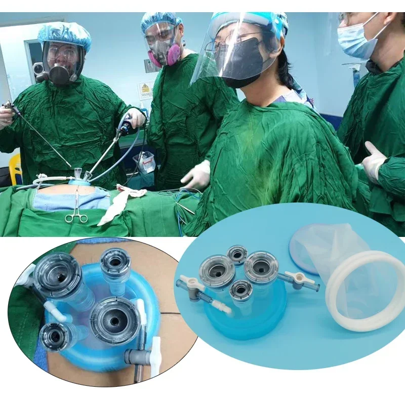 Одноразовый лапароскопический Однопортовый одноразовый