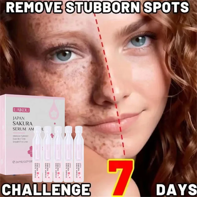 Отбеливающая сыворотка для лица с веснушками удаление мелазмы темных пятен